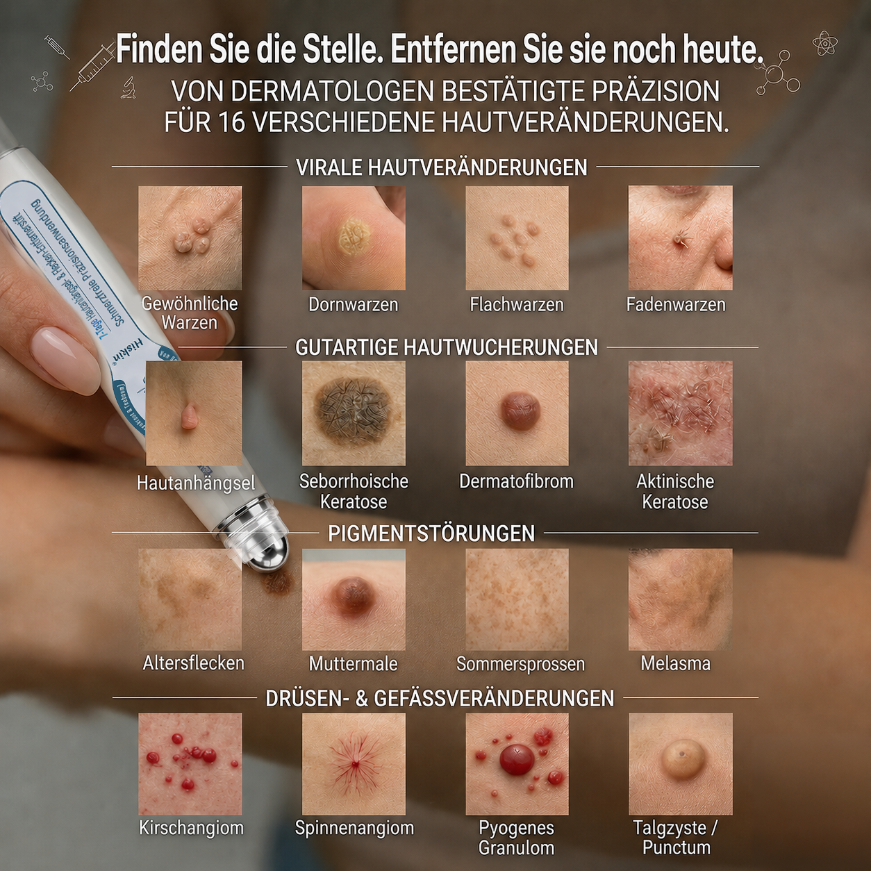 HISKIN®👩‍⚕️ 7-Tage-Hautmakel- & Hautanhängsel-Entferner Schmerzfreier Rollerball-Stift zur schonenden Entfernung von Hautanhängseln und Hautflecken – narbenfrei